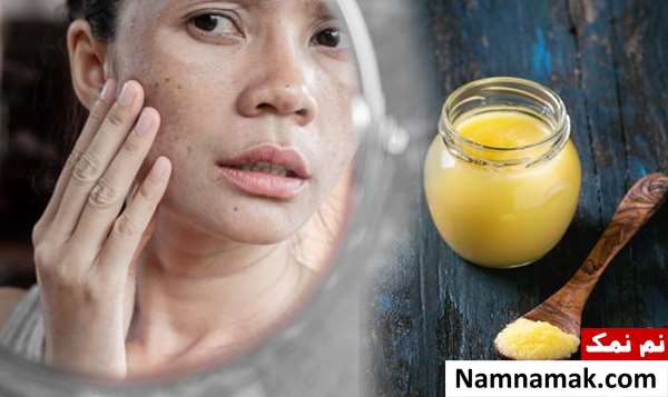 معجزه عسل برای رفع سیاهی دور چشم