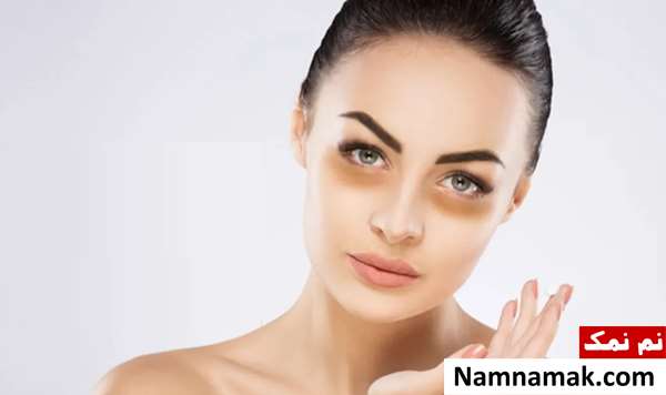 قرص برای رفع سیاهی دور چشم