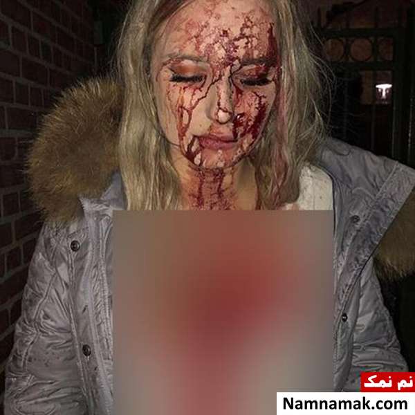 عاقبت وحشتناک حضور یک دختر در پارتی شبانه+تصاویر