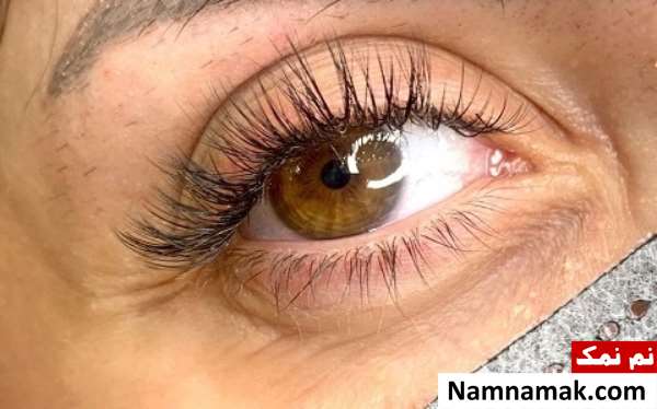 کاشت مژه والیوم گربه ای