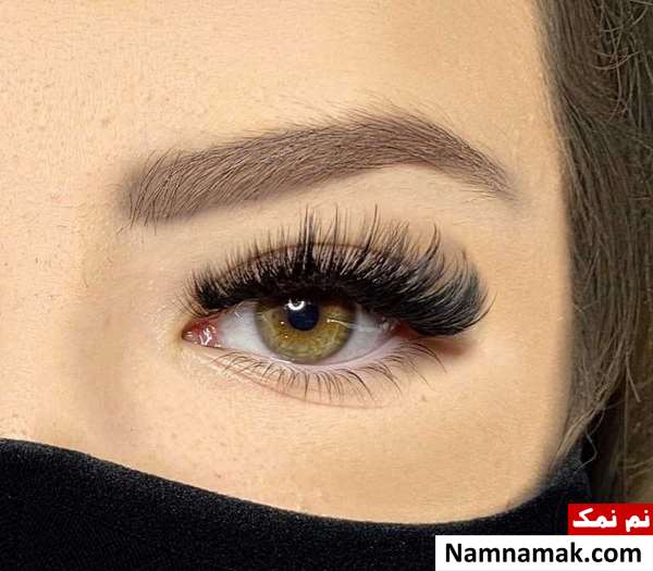 کاشت مژه اسپایکی
