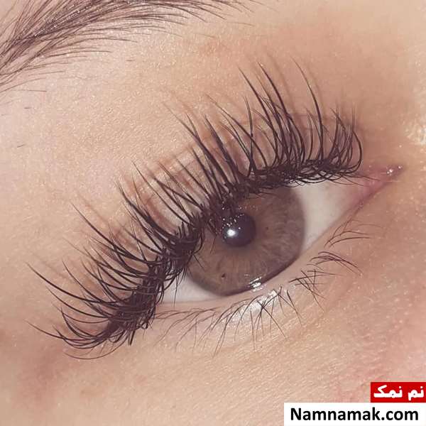 کاشت مژه اسپایکی