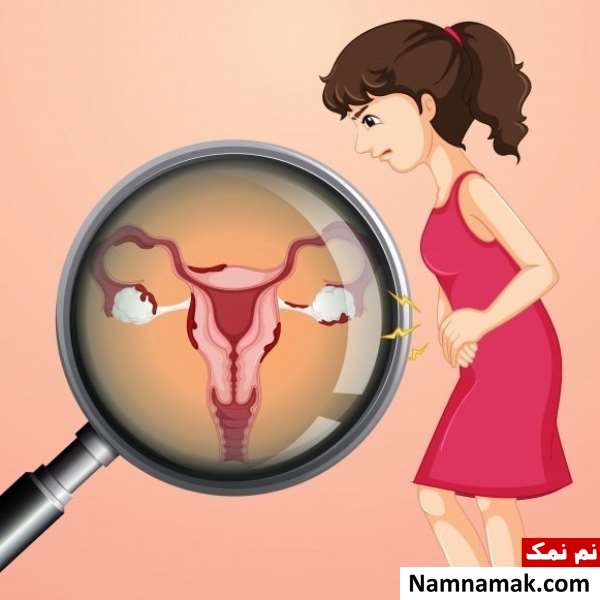 خواص خرما برای زنان