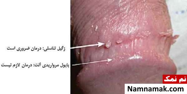 بیماری های پوستی دستگاه تناسلی مردان