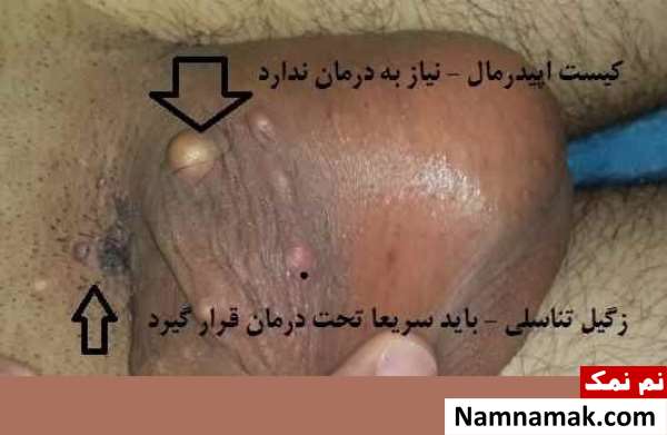بیماری های پوستی دستگاه تناسلی مردان
