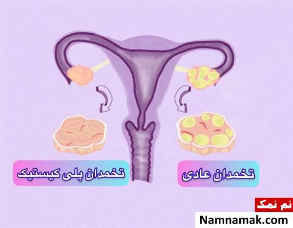 خواص و فواید سیر خام برای تخمدان