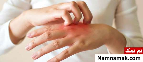 کرم ضد آفتاب دست کرم ضد آفتاب دست