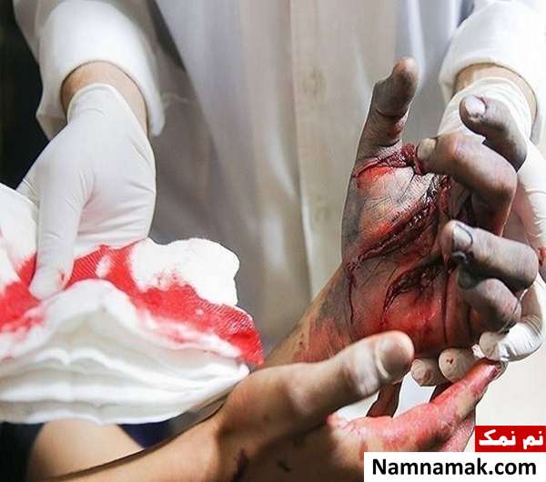 صحنه های دلخراش چهارشنبه سوری