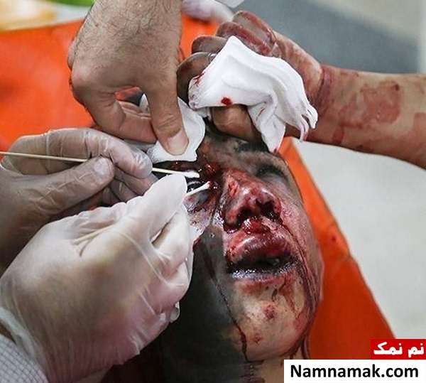 صحنه های دلخراش چهارشنبه سوری