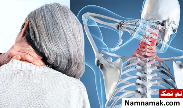 آرتروز گردن و درد دست راست آرتروز گردن و درد دست راست