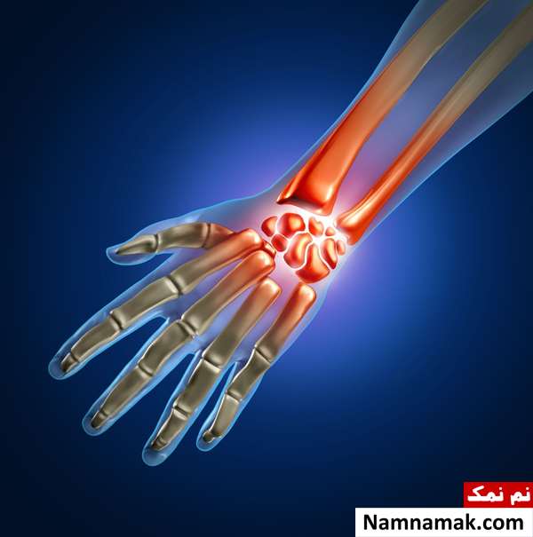دکتر و جراح ارتوپد دست چیست و چکار می کند؟