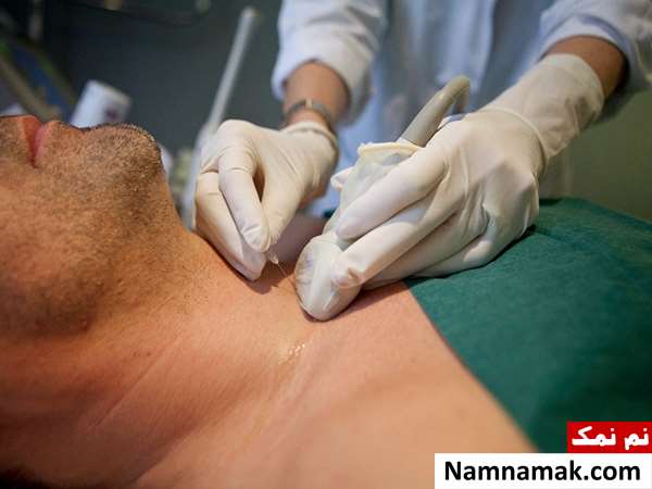 نمونه برداری از توده گلو نمونه برداری از توده گلو