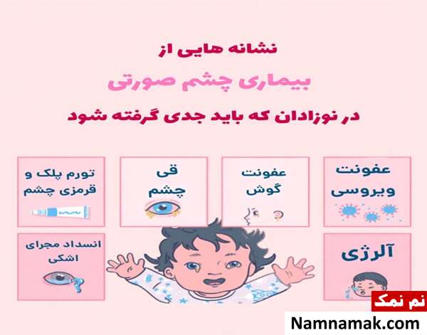 درمان قی کردن چشم کودک و نوزاد