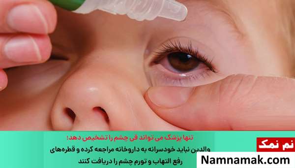 درمان قی کردن چشم کودک و نوزاد
