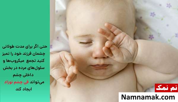 درمان قی کردن چشم کودک و نوزاد