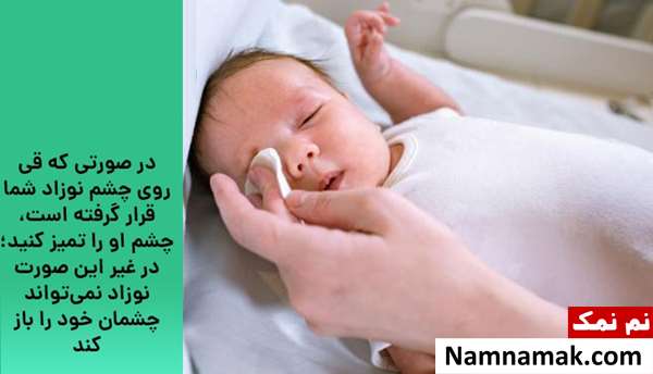 درمان قی کردن چشم کودک و نوزاد