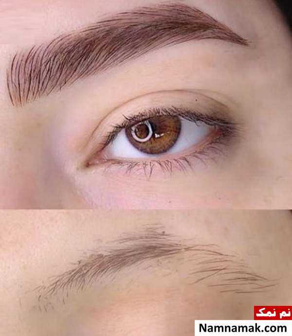 چه چیزی برای ریزش ابرو خوبه؟