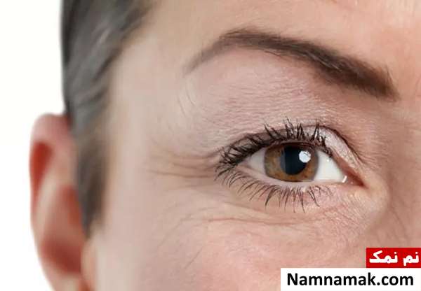 رفع چروک صورت در دو دقیقه