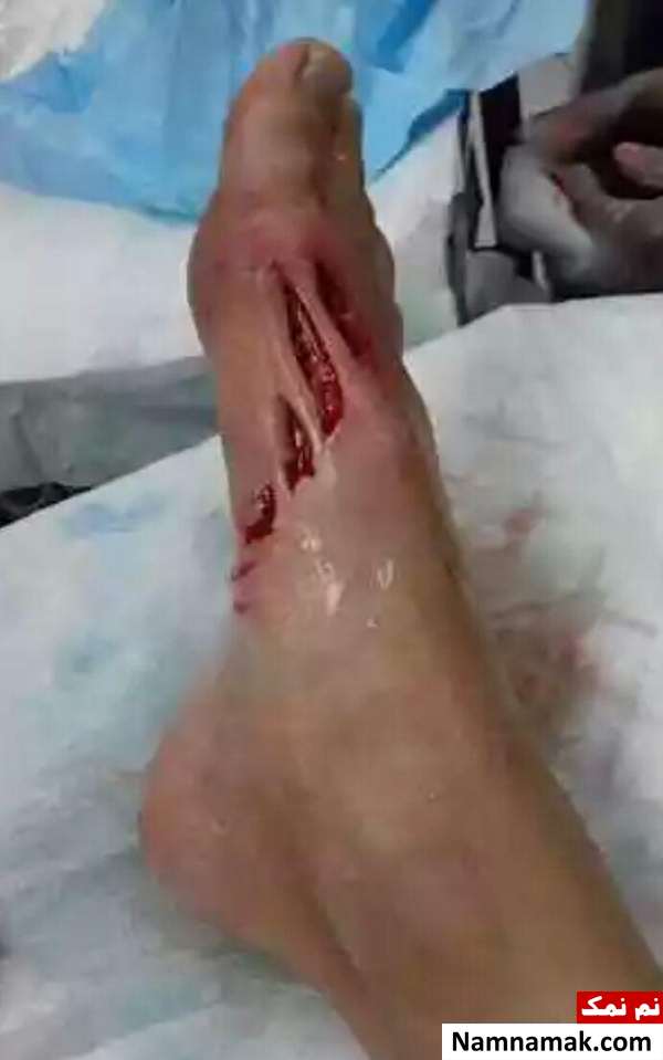 حمله مرگبار کوسه به پسر نوجوان + تصاویر
