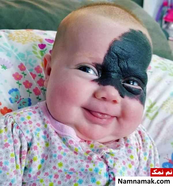 صورت عجیب نوزاد ،  والدینش را به وحشت انداخت! تصاویر