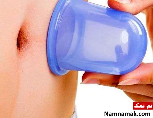 استفاده از بادکش برای لاغری