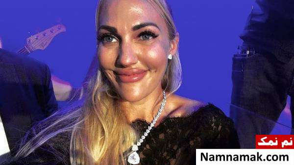 مریم اوزرلی خرم سلطان بعد از عمل زیبایی بوتاکس مریم اوزرلی خرم سلطان