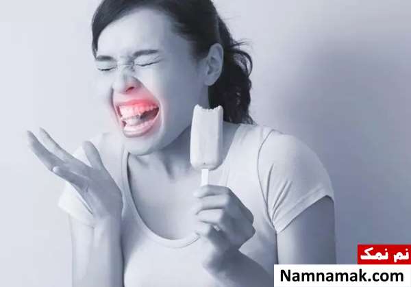 فلوراید