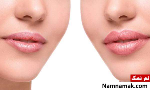 بزرگ کردن لب ها با دارچین قلوه ای کردن لب