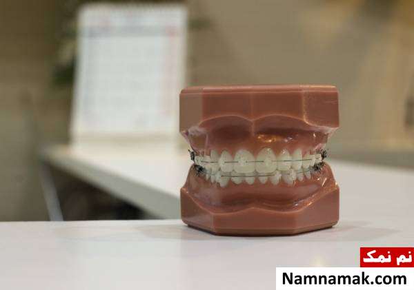 orthodontics