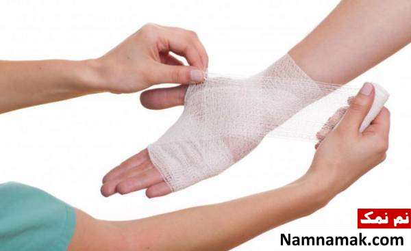 چگونه سوختگی را درمان کنیم؟ درمان سوختگی