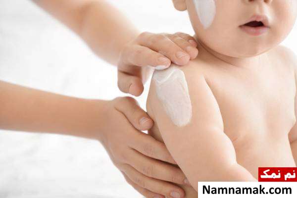 آفتاب سوختگی پوست کودک
