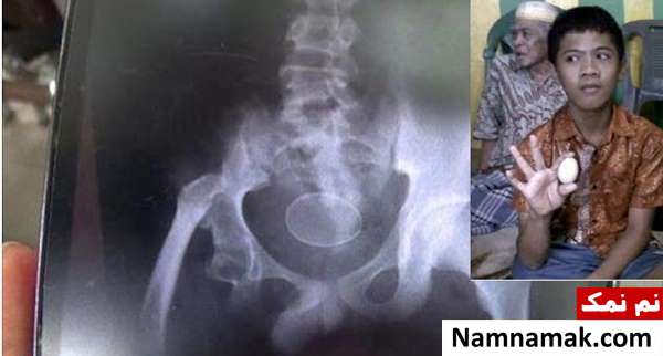 پسر تخم مرغ