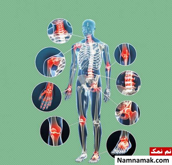 مواد غذایی برای آرتروز 