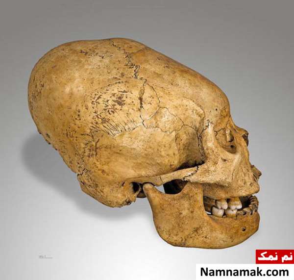 کشف جمجمه فرازمینی ها