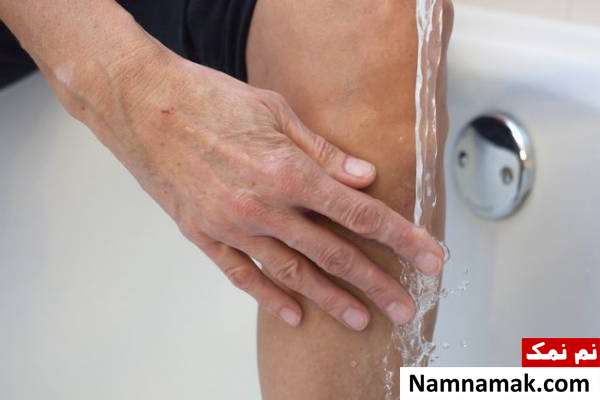حس سوزش بعد اصلاح چرا بعد اصلاح سوزش داریم؟