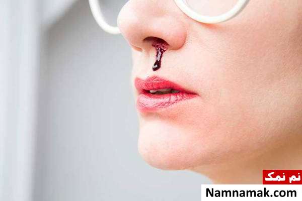 خون دماغ شدن چه علتی دارد؟