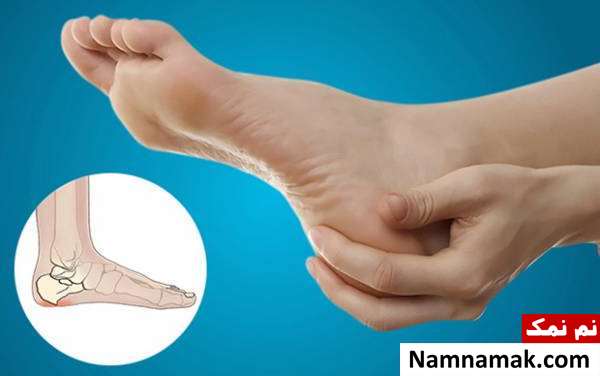 پیشگیری از خار پاشنه جلوگیری از خار پاشنه