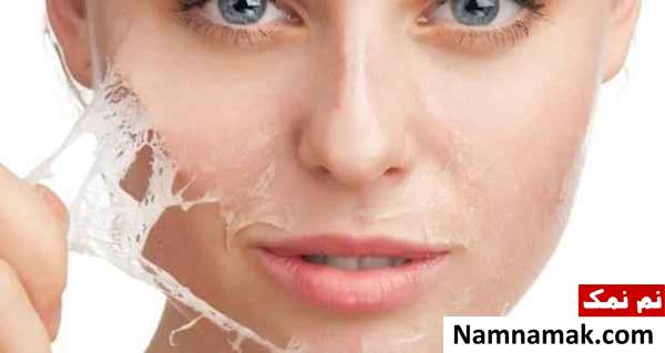 همه چیز در مورد جوش صورت درمان جوش صورت
