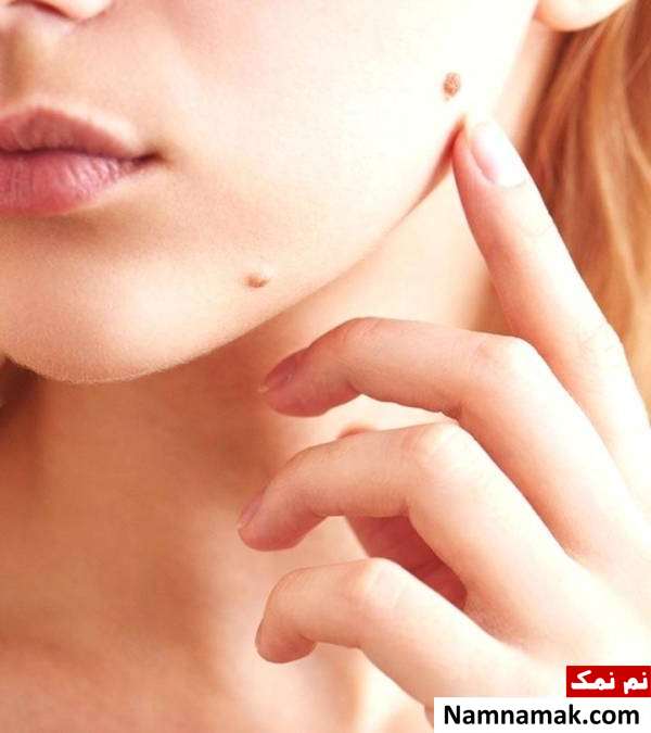 شخصیت شناسی از روی خال