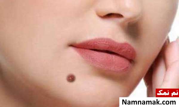 شخصیت شناسی خال روی چانه