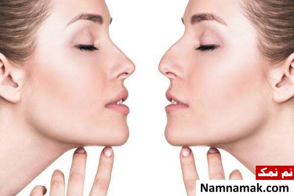 اصول مهم مراقبت بعد از عمل جراحی بینی اصول مهم مراقبت های بعد از عمل جراحی زیبایی بینی