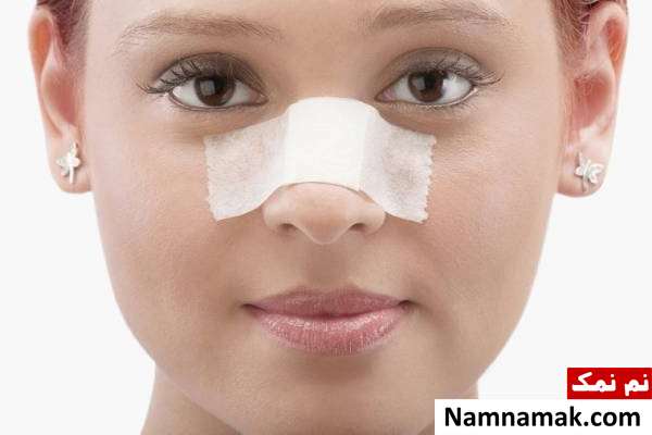 مراقبت بعد از عمل بینی مهم ترین نکات برای مراقبت بعد از عمل بینی
