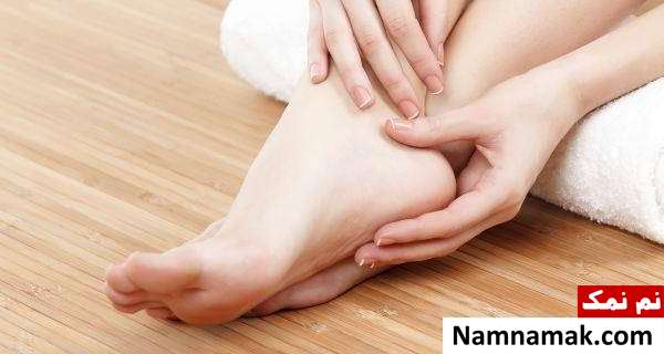 علائم کهیر زدن کهیر چه نشانه های دارد