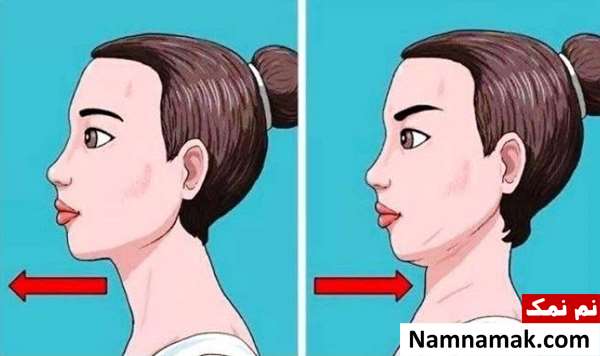 رفع چال چانه بدون جراحی در خانه
