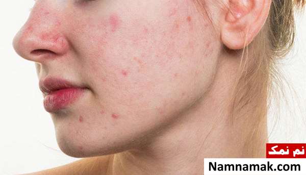 ماسک صورت خانگی ماست و خیار ماسک صورت خانگی ماست و خیار