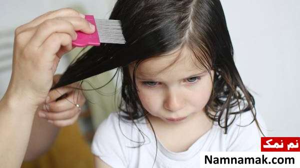 شپش مو کودک شپش مو کودک را چگونه تشخیص دهیم؟