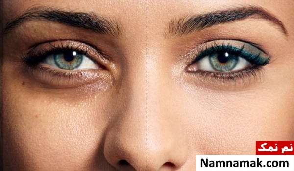 علل سیاهی دور چشم دلایل سیاهی دور چشم