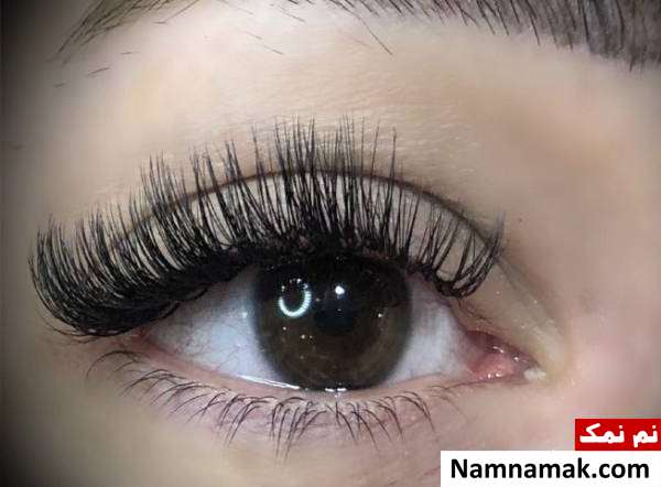 کاشت مژه مصنوعی چه عوارضی دارد؟