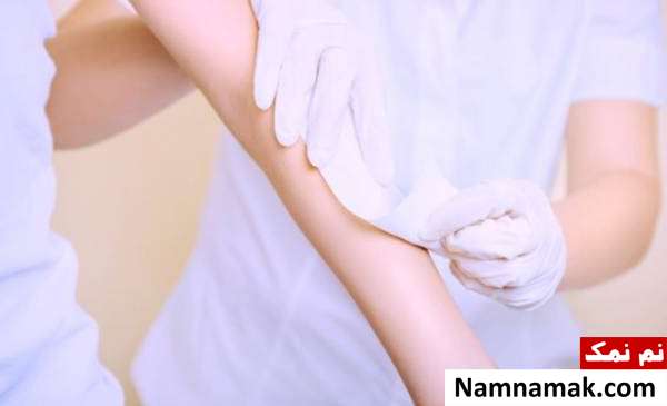 علت جوش بعد از اپیلاسیون به چه علتی بعد از انجام اپیلاسیون جوش می زنیم