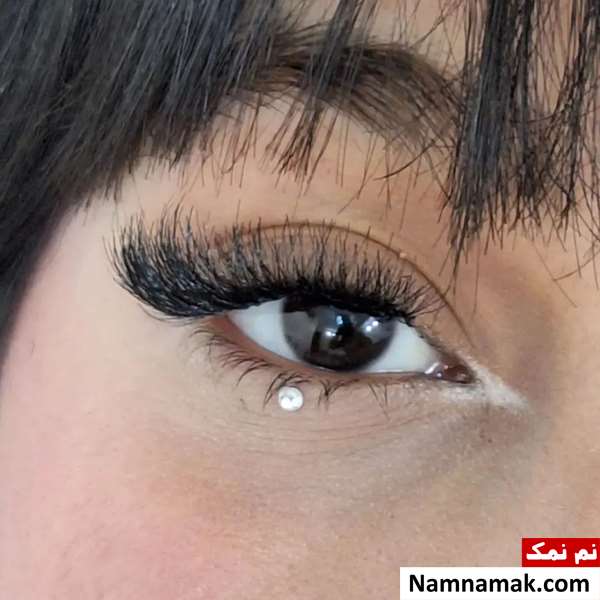 روش میکروسرجری